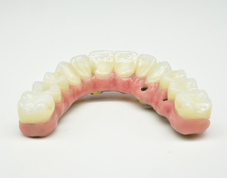 Zirconia Hybrid (Prep Bar) Peterson Dental Laboratory