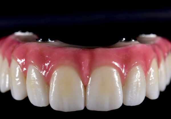 CE418C37-8FA5-4D1B-AE14-F32A830AA891 CE418C37-8FA5-4D1B-AE14-F32A830AA891